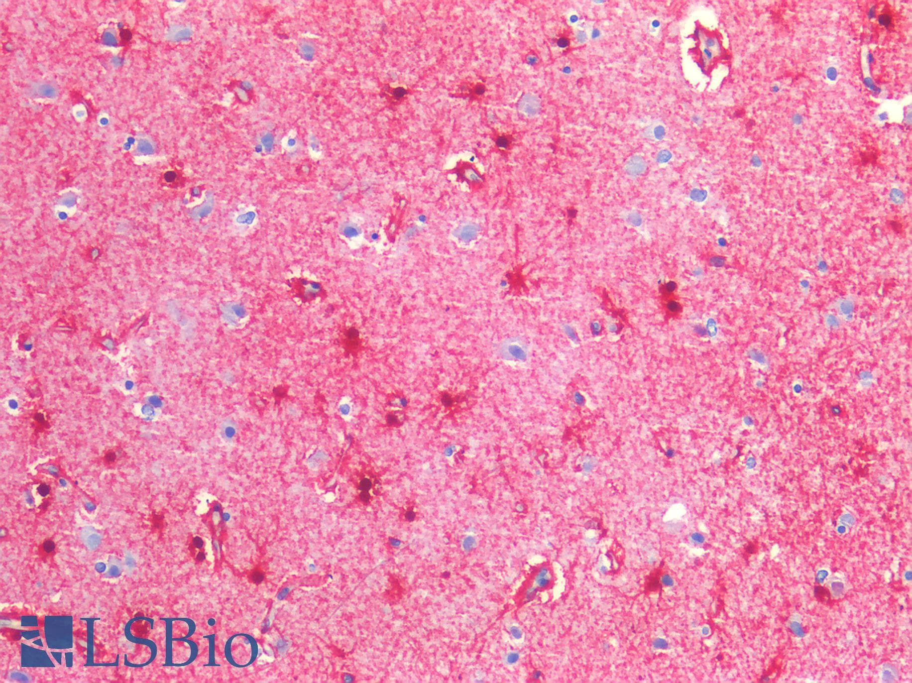 PathPlus™ Polyclonal Rabbit anti-Human GFAP Antibody (IHC)