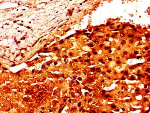 Polyclonal Rabbit anti-Human HIST1H2AI Antibody (IHC, IF)
