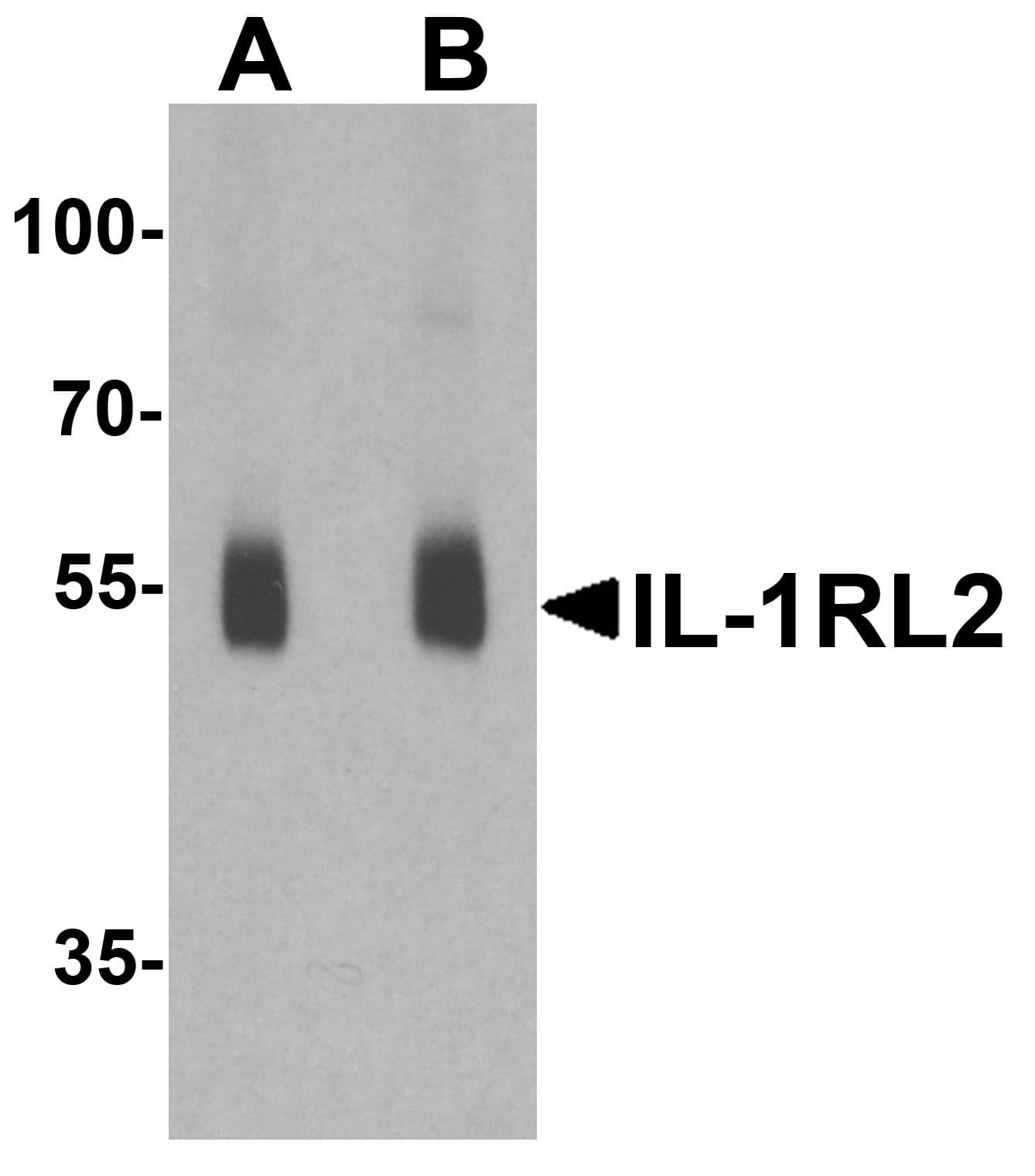 Polyclonal Rabbit anti-Human IL1RL2 Antibody (IHC, IF, WB)