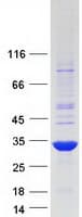 Human TRH Protein (Recombinant Myc-DDK (Flag))