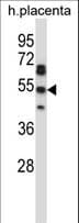 TEAD2 Antibody (aa267-295)