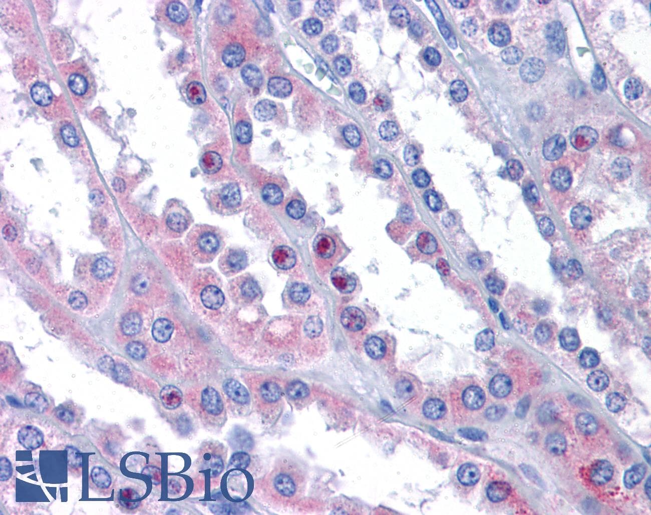 IHC-plus™ NAA35 Antibody