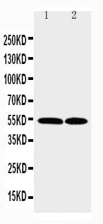 Polyclonal Rabbit anti-Human CCR3 Antibody (aa1-20, IHC, WB)