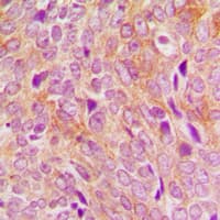 POLG2 Antibody (Internal)