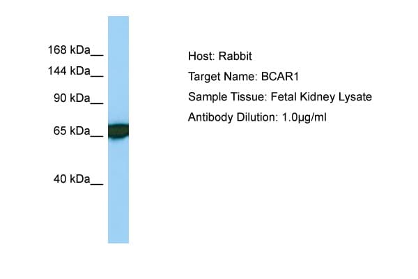 BCAR1 / p130Cas Antibody (aa456-505)