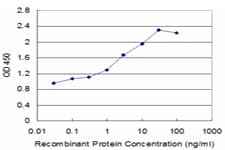 Monoclonal Mouse anti-Human SLC14A2 / UTR Antibody (clone 3E7)