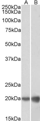 IHC-plus™ DUT / DUTPase Antibody