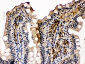 Polyclonal Rabbit anti-Human SMC3 / HCAP Antibody (IHC, WB)