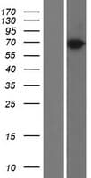 TRIM47 Protein (Over-Expression Lysate Myc-DDK (Flag))