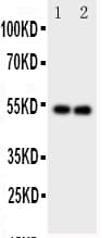 Polyclonal Rabbit anti-Human GABRA1 Antibody (aa440-456, IHC, WB)