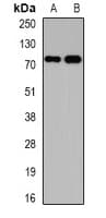Polyclonal Rabbit anti-Human KCND3 / Kv4.3 Antibody (IHC, WB)