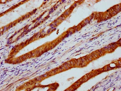Polyclonal Rabbit anti-Human PARS2 Antibody (IHC)