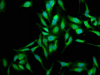 IHC-plus™ SOD2 / Mn SOD Antibody (aa64-175)