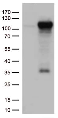 Monoclonal Mouse anti-Human GTF3C4 Antibody (clone OTI4A3, aa583-822, IHC, WB)