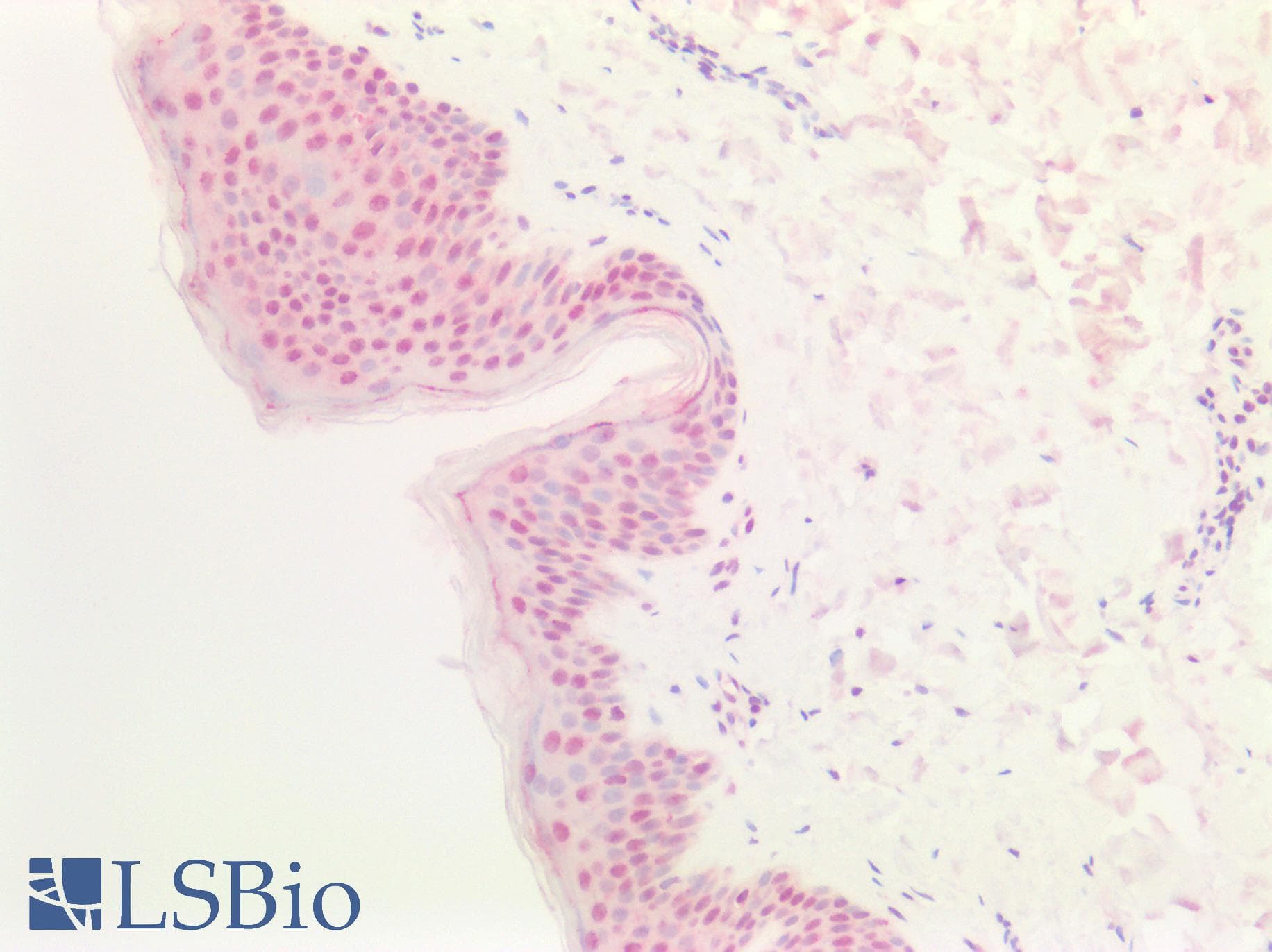 PathPlus™ MEN1 / Menin Antibody (aa575-C-term)