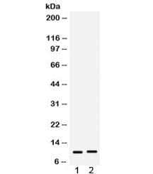 S100A6 / Calcyclin Antibody
