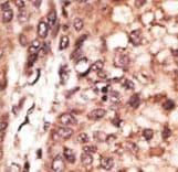 Polyclonal Rabbit anti-Human OASIS / CREB3L1 Antibody (aa491-519, IHC, WB)