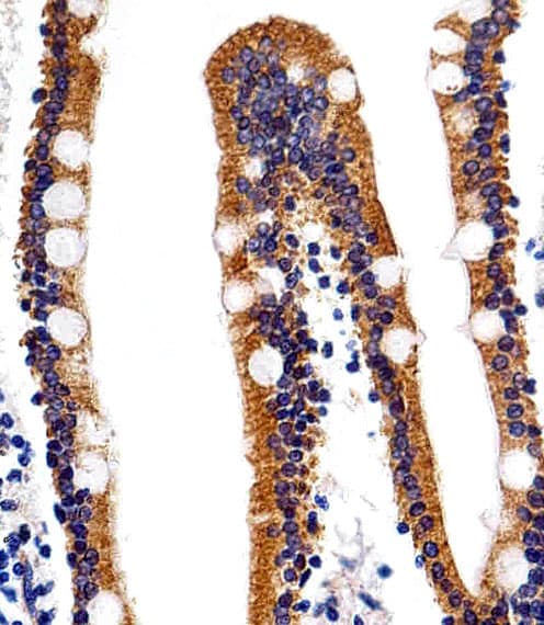 ACVRL1 Antibody (aa11-44)