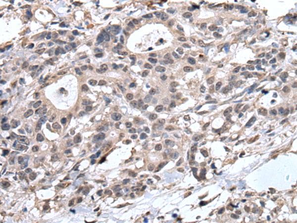 TRIM27 Antibody