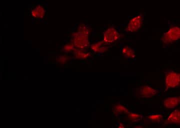 HOXD8 Antibody