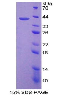 Human GC / Vitamin D-Binding Protein (Recombinant His-GST)