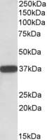 IHC-plus™ CYB5R3 / B5R Antibody (aa317-330)