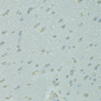 NCOA2 / TIF2 Antibody