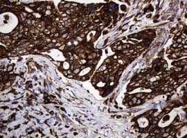 Monoclonal Mouse anti-Human POGK Antibody (clone OTI3E2, IHC, WB)