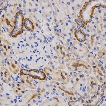 PIBF1 / PIBF Antibody