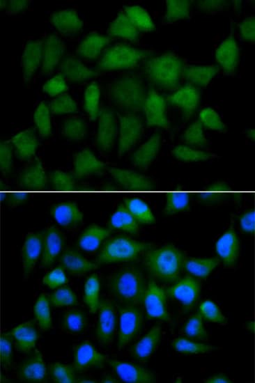 Alpha-Fetoprotein Antibody