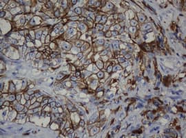 CDH1 / E Cadherin Antibody (clone OTI1B11)