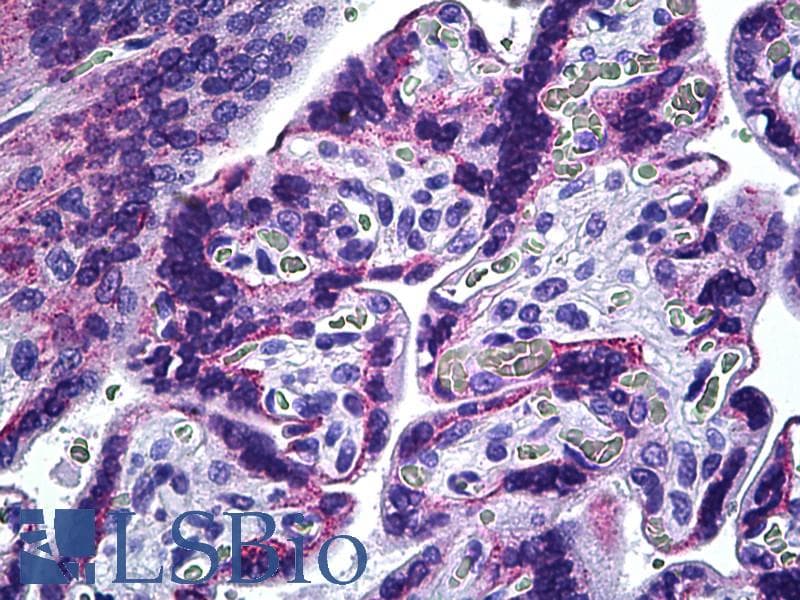 IHC-plus™ Polyclonal Rabbit anti-Human CIB2 / KIP2 Antibody (aa21-70, IHC)