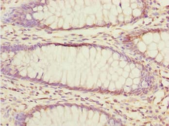 EYA3 Antibody