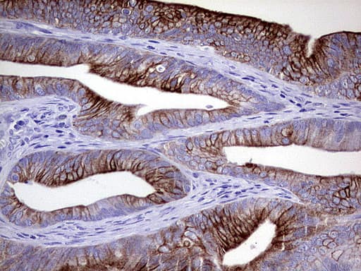 Monoclonal Mouse anti-Human KRT20 / CK20 / Cytokeratin 20 Antibody (clone UMAB167, Carrier-free, IHC, WB)
