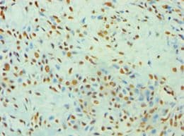 Polyclonal Rabbit anti-Human XRCC5 / Ku80 Antibody (aa543-732, IHC, WB)