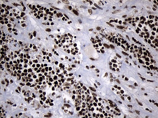 POLR2A / RNA polymerase II Antibody (aa1351-1614, clone OTI2B7)
