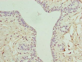 ARMT1 Antibody