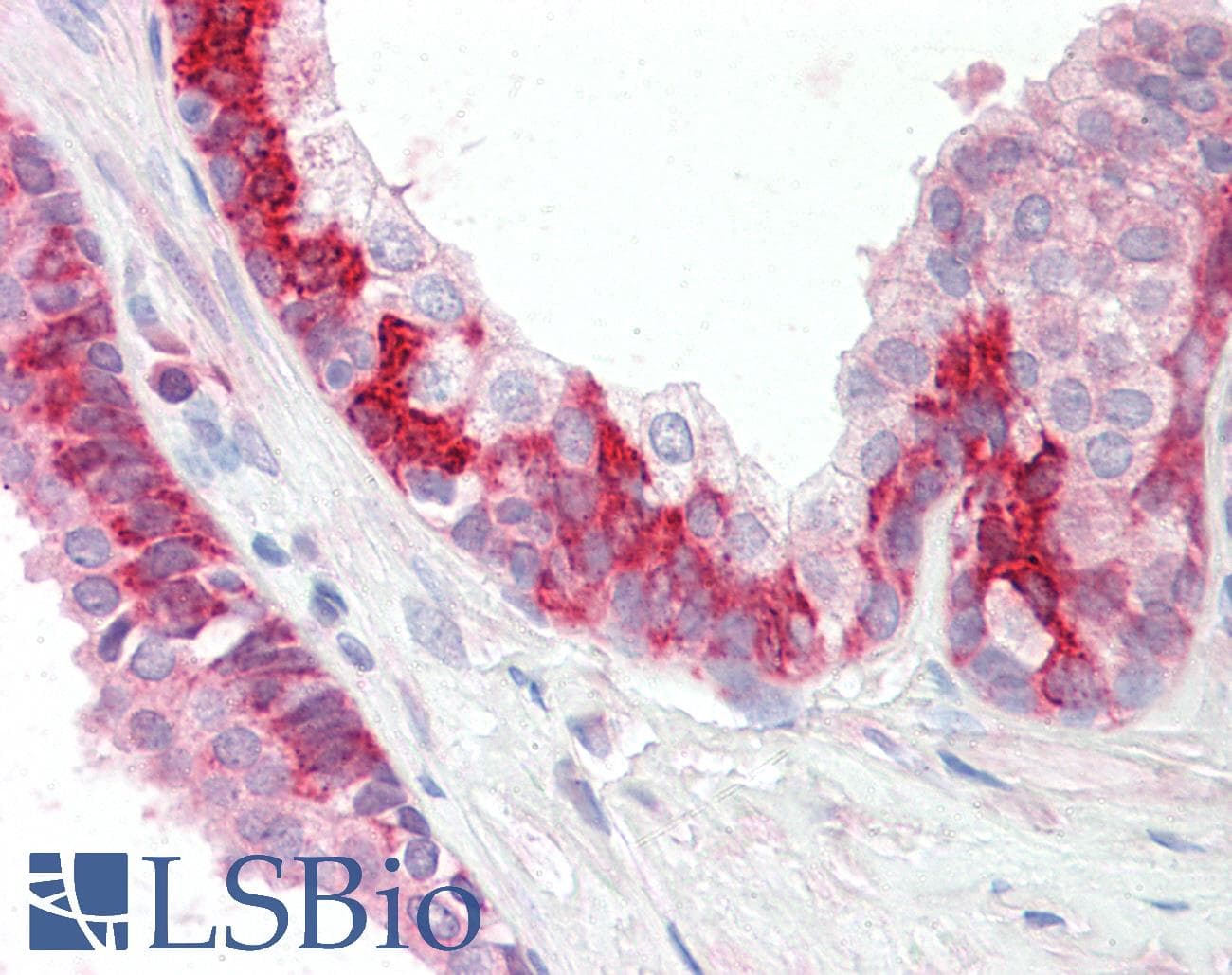 IHC-plus™ KEAP1 Antibody