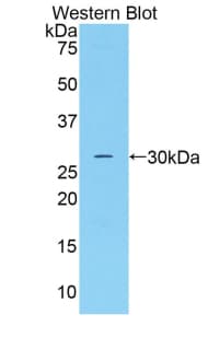 CFD / Factor D / Adipsin Antibody (aa1-263)