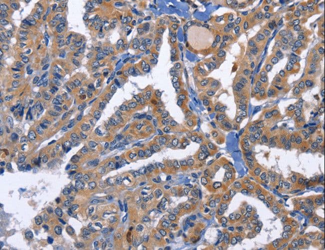 PRKCD / PKC-Delta Antibody