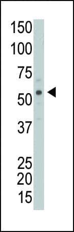 PICK1 Antibody (aa1-30)