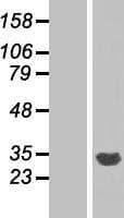 CYB5R2 Protein (Over-Expression Lysate Myc-DDK (Flag))