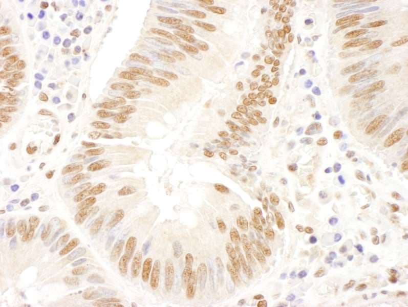 FANCD2 Antibody (aa1401-1451)