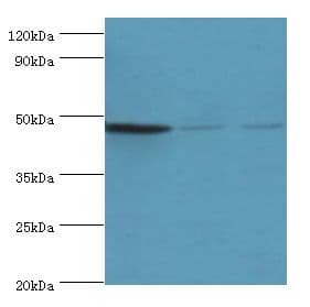 ENTPD5 / CD39L4 Antibody (aa149-428)
