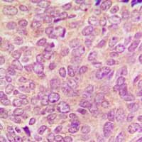 PRKCA / PKC-Alpha Antibody (C-Terminus)