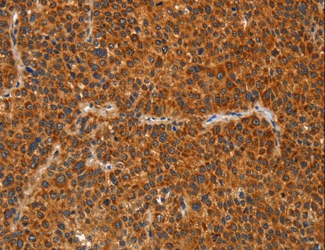 Polyclonal Rabbit anti-Human IKZF3 / AIOLOS Antibody (IHC)