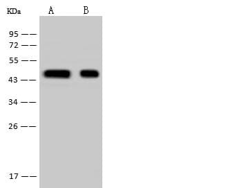 HSDL2 Antibody