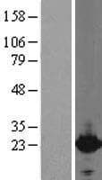 CYGB / Cytoglobin Protein (Over-Expression Lysate Myc-DDK (Flag))