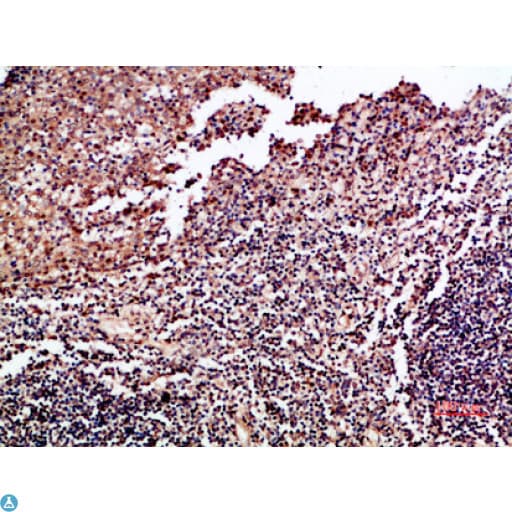 Polyclonal Rabbit anti-Human CSF2 / GM-CSF Antibody (IHC)
