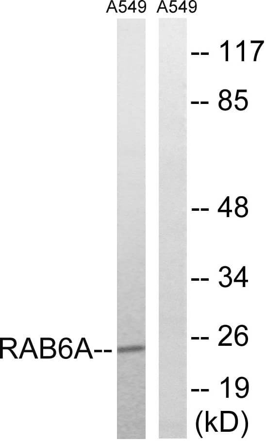 RAB6A / RAB6 Antibody (aa113-162)